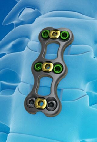 Spinal Plates